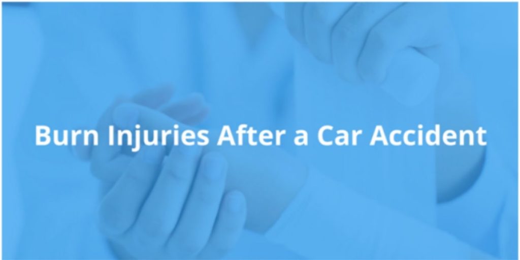 Burn Injuries After a Car Accident