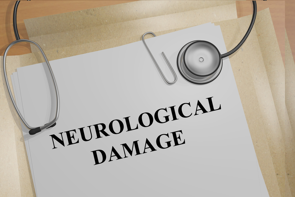 Brain Injury Damages