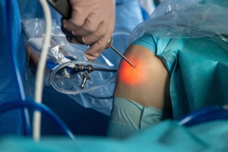 Average Settlement Amount for Arthroscopic Surgery