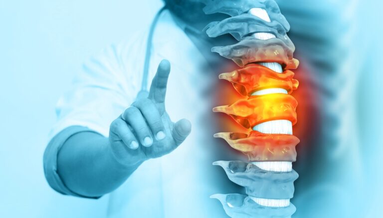 Average Settlement for Spinal Cord Injury