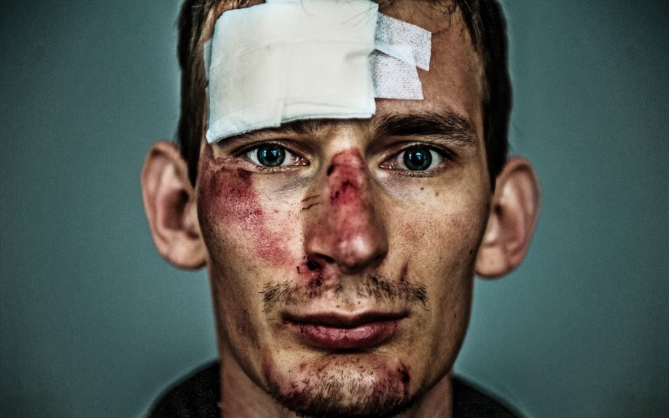 Can You File Both Workers’ Comp And Personal Injury