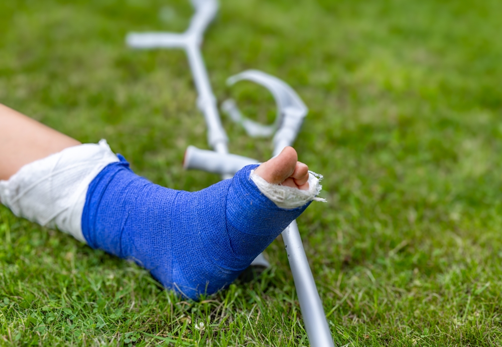 Average Settlement for a Broken Leg Injury